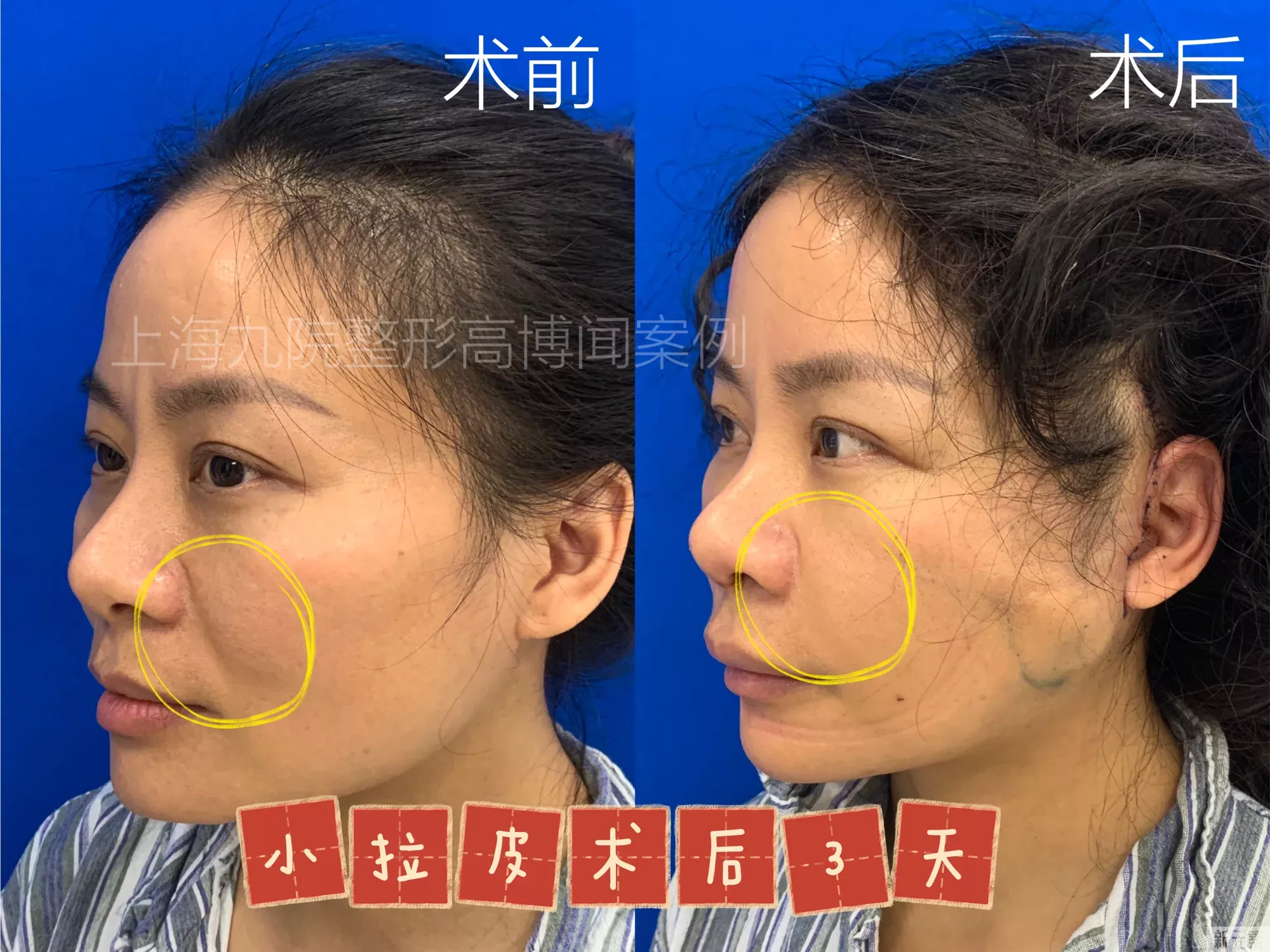 小拉皮真的很小嘛? 图片-2