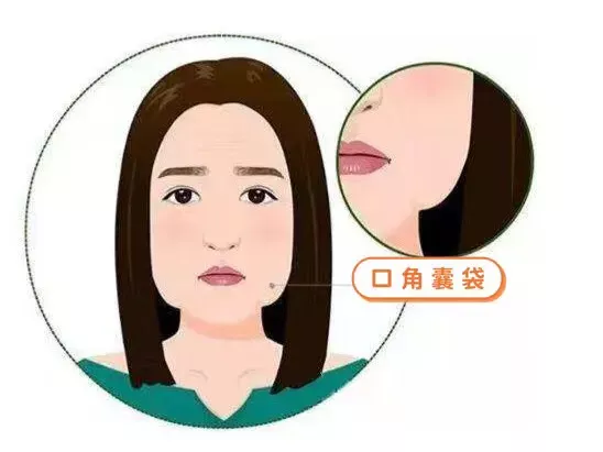 小拉皮真的很小嘛? 图片-3