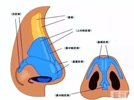隆鼻后,鼻子会一碰就歪么? 图片-10