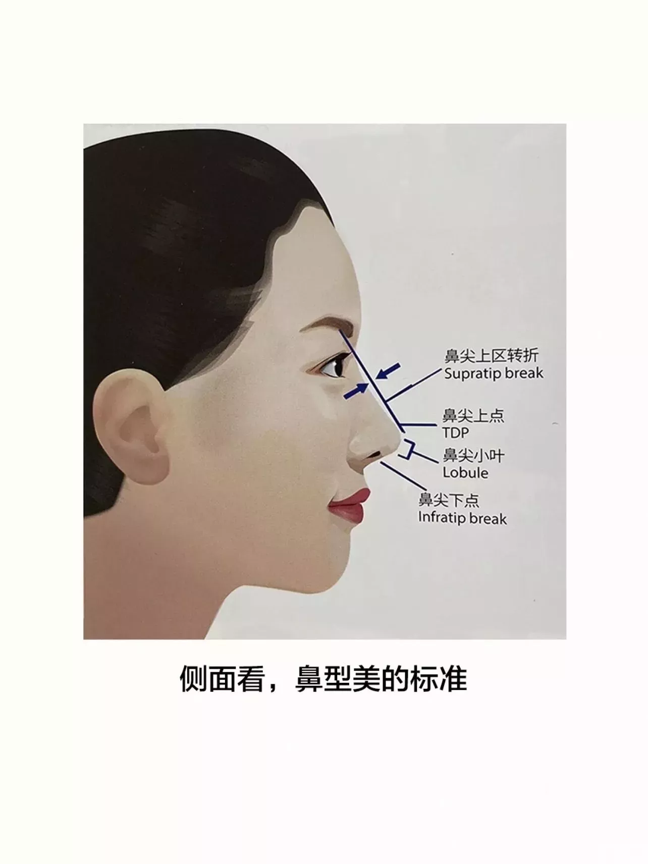 医生眼中的理想妈生自然鼻细节要点! 图片-6