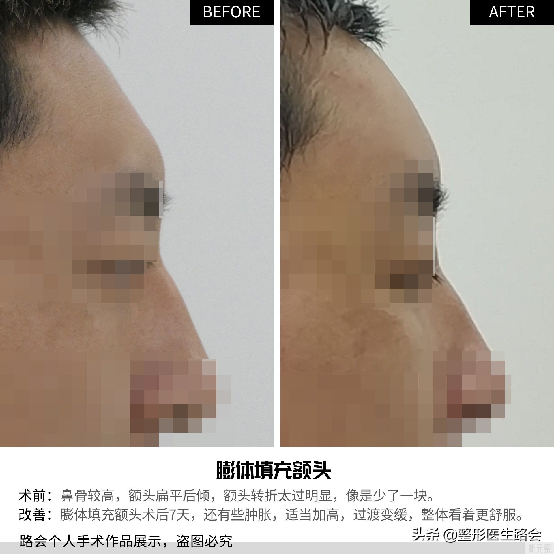 男神“姨化”,可能都是它惹的祸?! 图片-3