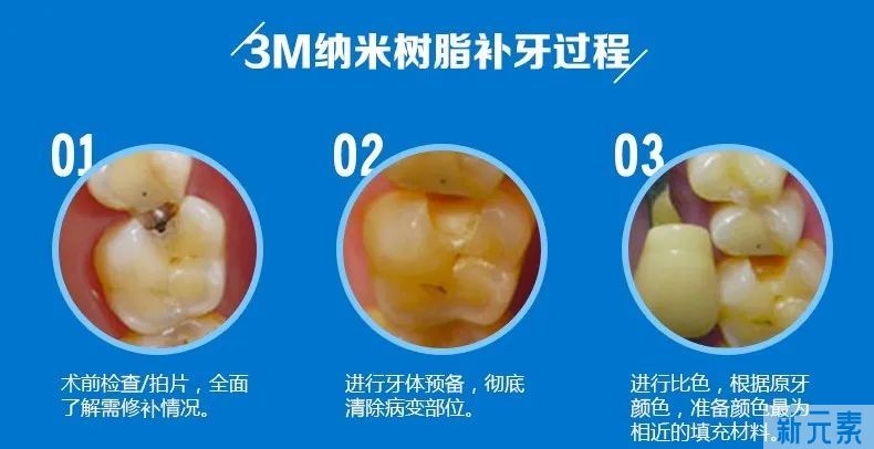 如何有效清洁牙齿?让孩子避免龋齿? 图片-6