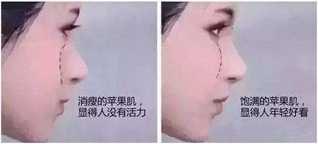❓这个部位下垂了,衰老也就来了..... 图片-2