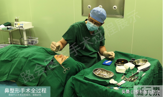 隆鼻手术全过程「真实细节」分享,想要做鼻子的姑娘一定要看看 图片-12