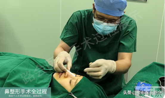 隆鼻手术全过程「真实细节」分享,想要做鼻子的姑娘一定要看看 图片-14