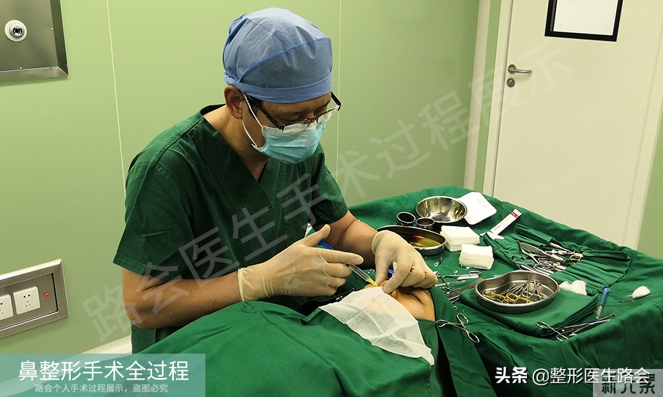 隆鼻手术全过程「真实细节」分享,想要做鼻子的姑娘一定要看看 图片-16