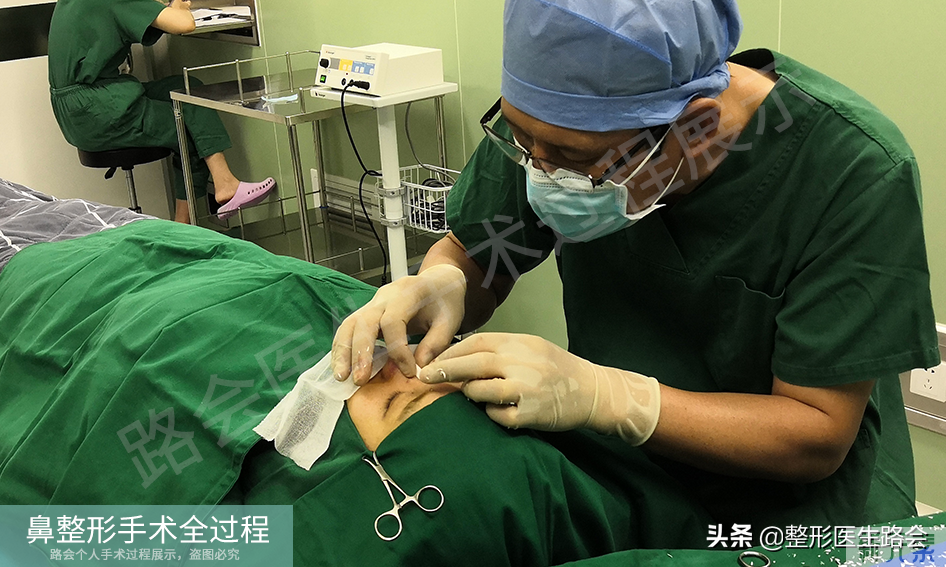 隆鼻手术全过程「真实细节」分享,想要做鼻子的姑娘一定要看看 图片-21