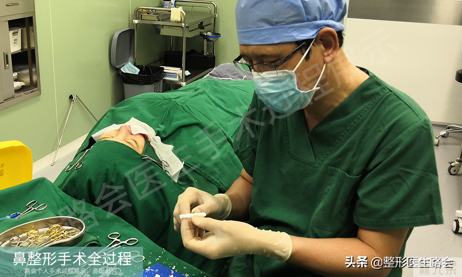 隆鼻手术全过程「真实细节」分享,想要做鼻子的姑娘一定要看看 图片-20