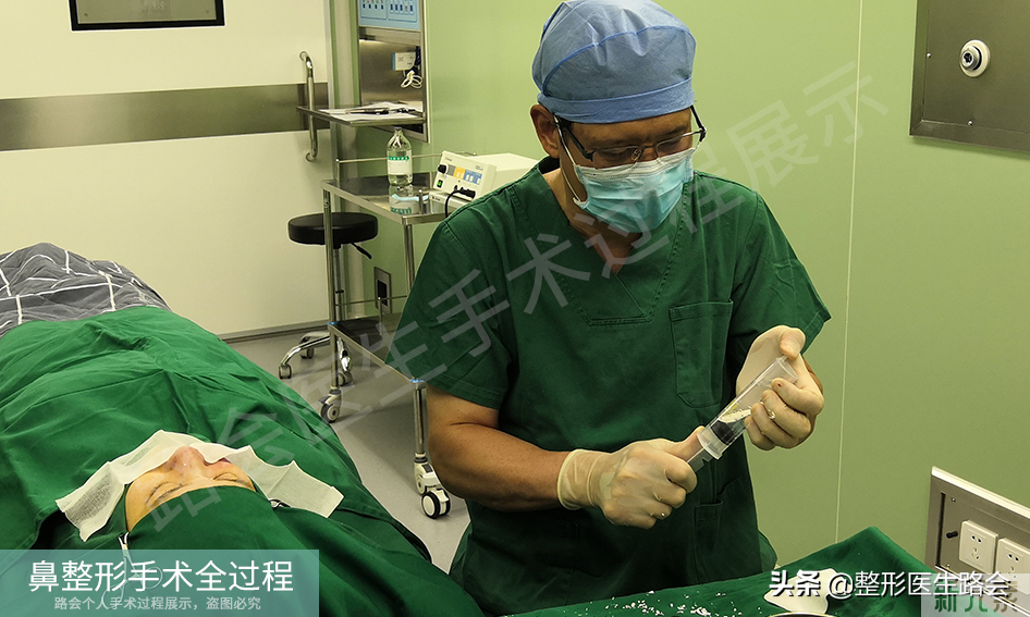隆鼻手术全过程「真实细节」分享,想要做鼻子的姑娘一定要看看 图片-22
