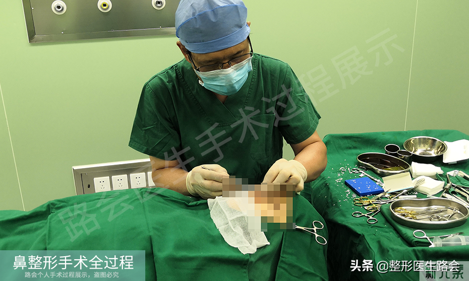 隆鼻手术全过程「真实细节」分享,想要做鼻子的姑娘一定要看看 图片-24