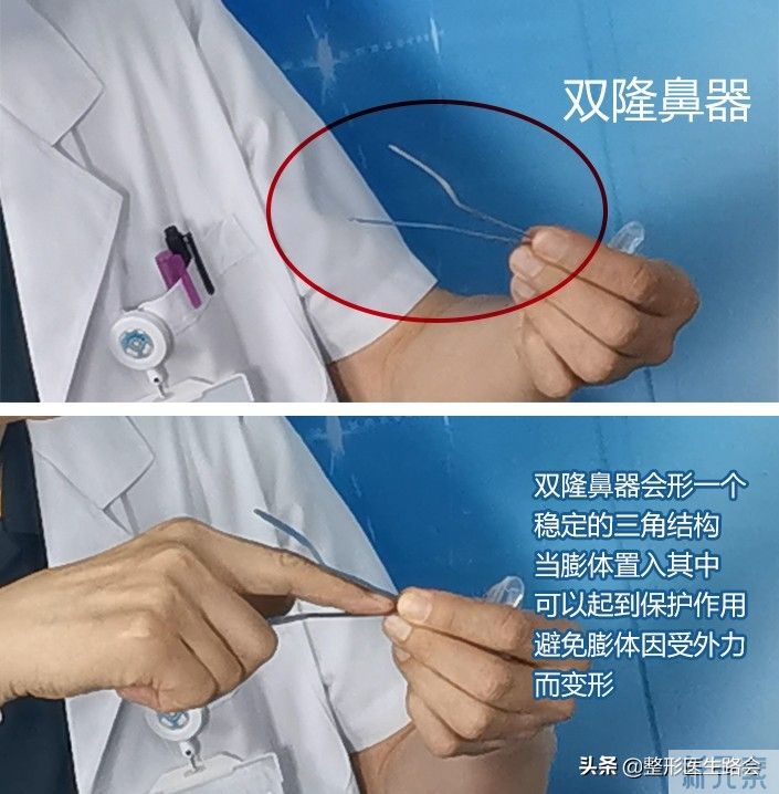 隆鼻手术全过程「真实细节」分享,想要做鼻子的姑娘一定要看看 图片-25