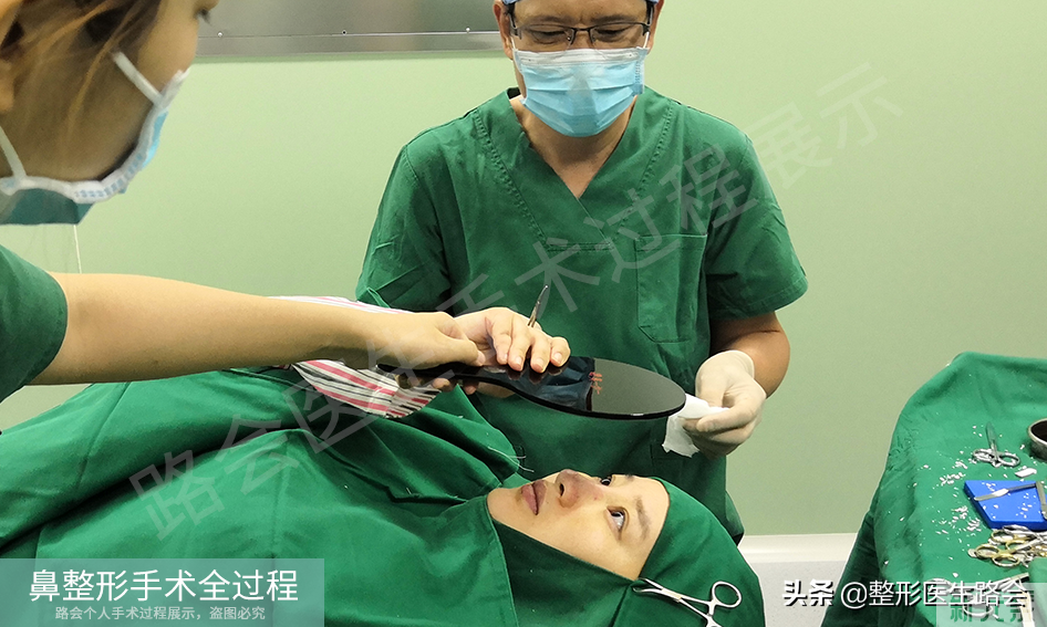 隆鼻手术全过程「真实细节」分享,想要做鼻子的姑娘一定要看看 图片-29