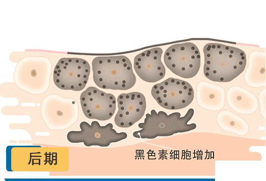皮肤受损后,出现色素沉着应该这样做! 图片-5