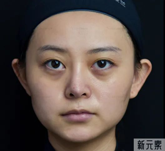 艾尔建全球注射导师王晔博士,3月12日亲诊速约! 图片-4