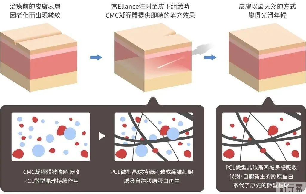 艾尔建全球注射导师王晔博士,3月12日亲诊速约! 图片-8