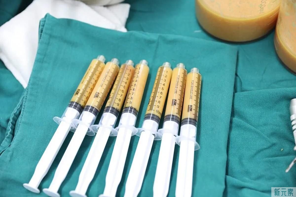 医美抗衰项目怎么选?整形医生的省钱攻略来了 图片-2