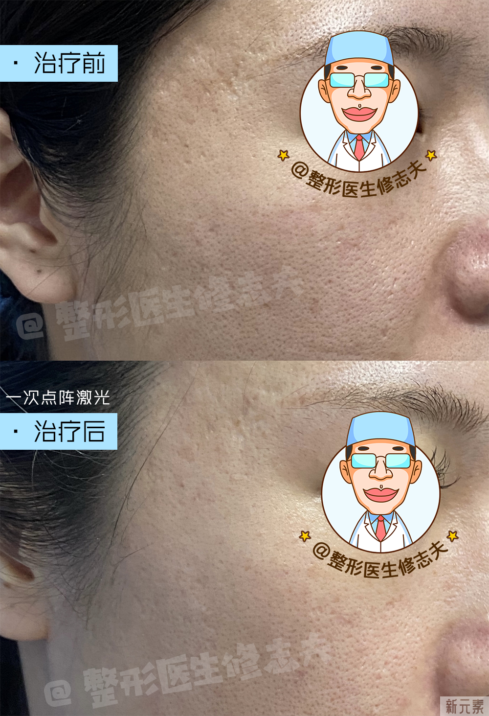 缩毛孔的正确打开方式 图片-7