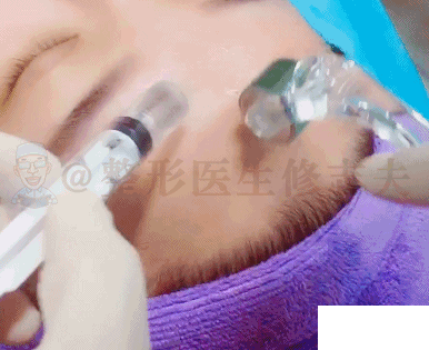 缩毛孔的正确打开方式 图片-8