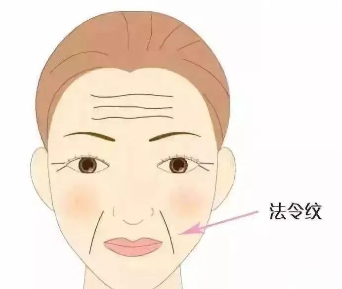 如何精准改善法令纹? 图片-4