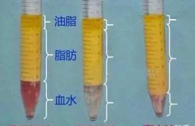 脂肪填充，不止抽出来、填进去那么简单 图片-2