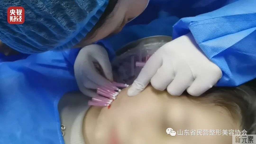 3·15晚会曝光丨女孩打玻尿酸致脑梗!揭秘非法医美速成班。合肥:立即严查 图片-9