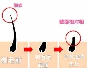 刮毛，真的会让毛越长越黑粗吗? 图片-3