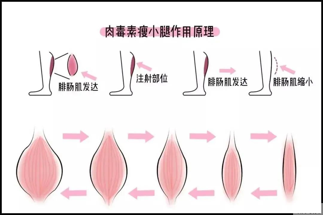 腿粗星人看过来，小粗腿秒变腿精全靠TA 图片-6