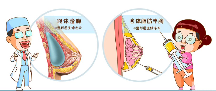 假体隆胸和脂肪丰胸都想要?没问题，安排 图片-2