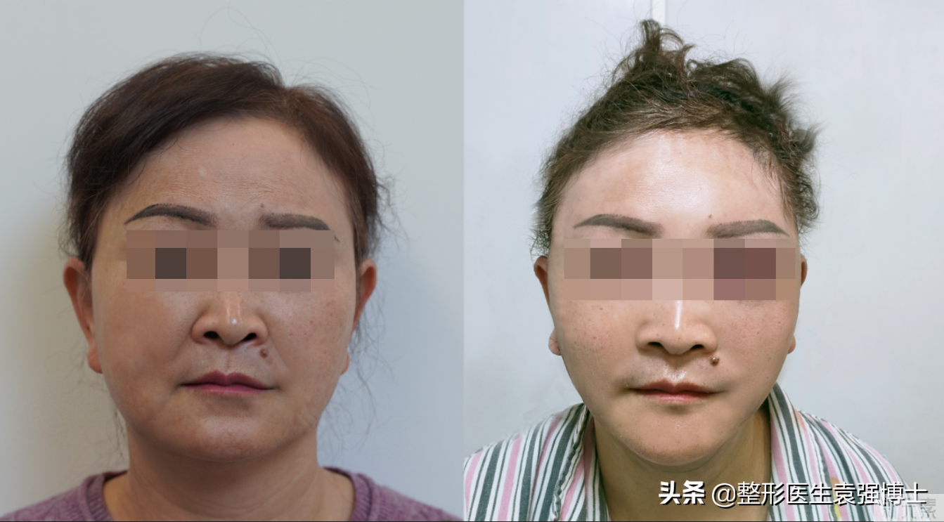 60岁从重庆来北京做大拉皮，我来给大家分享一下我的经历 图片-7