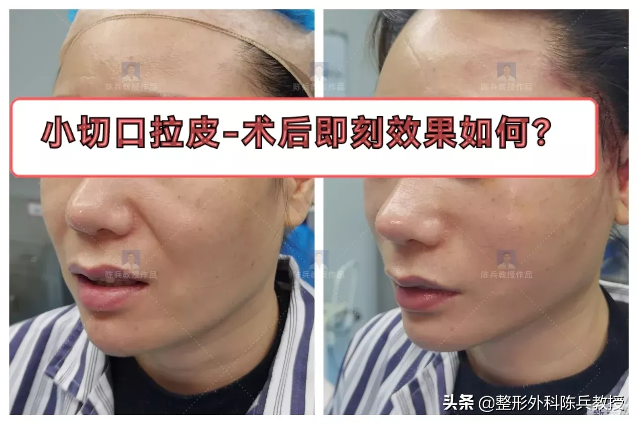 介意法令纹的美女看过来~ 图片-4
