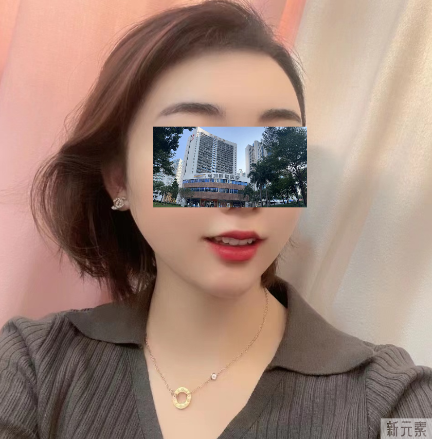 植发小白进