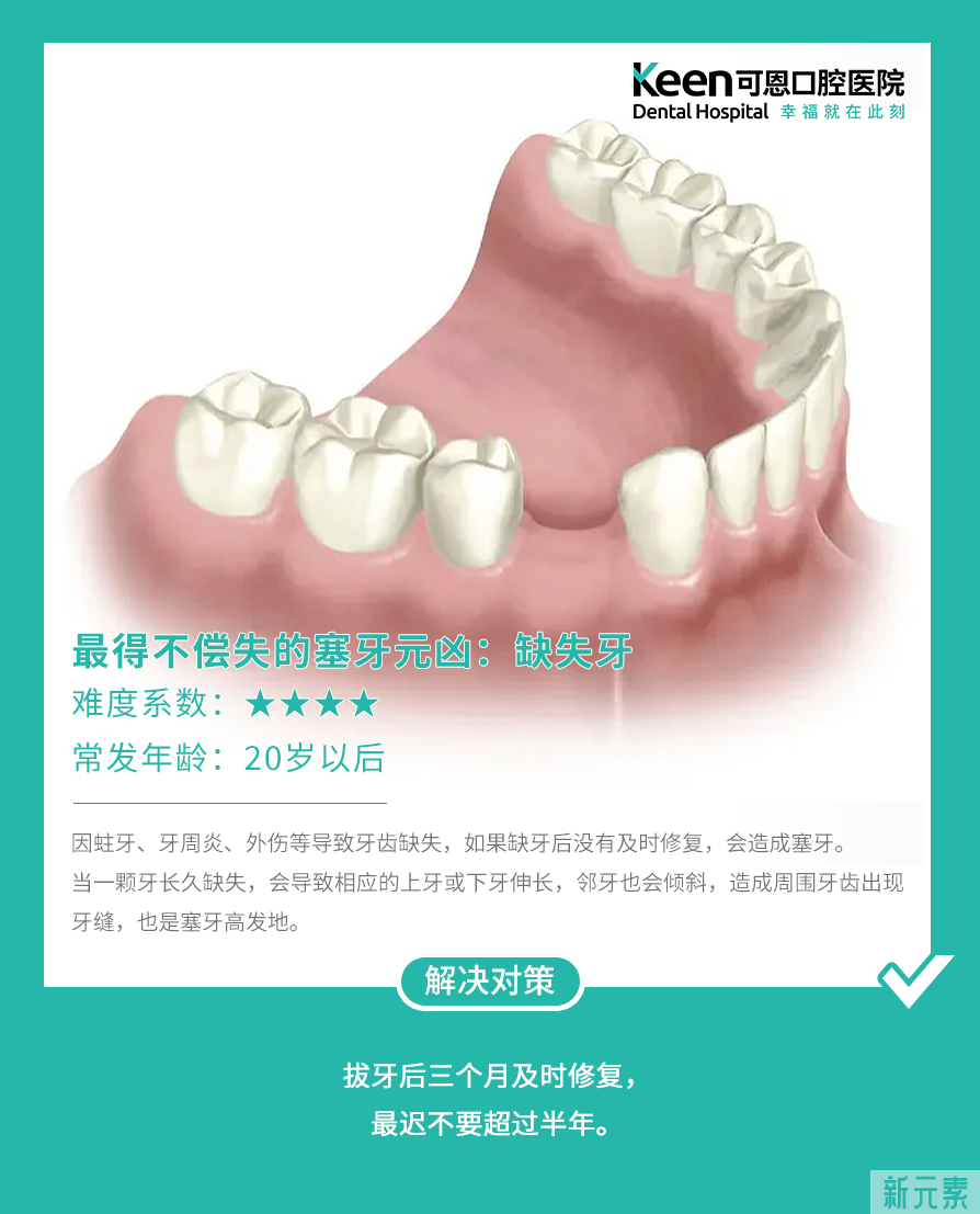 你为什么总塞牙?4个原因告诉你! 图片-6