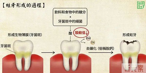 吃糖伤牙!嚼“木糖醇”，反而能预防龋齿吗? 图片-4