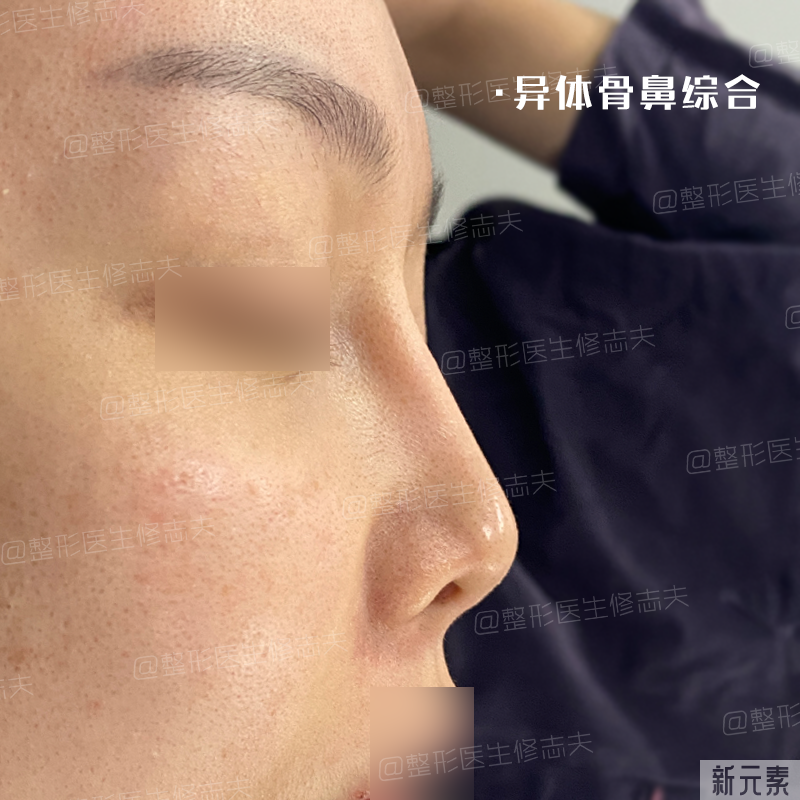 这就是所谓“年抛鼻”?更离奇的事出现了... 图片-7