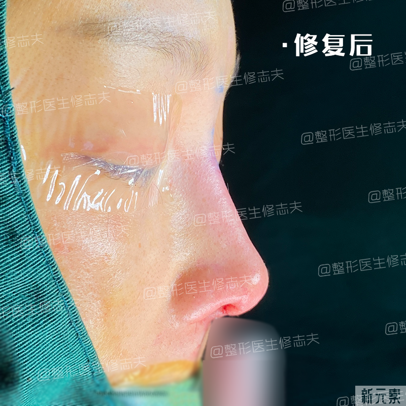 这就是所谓“年抛鼻”?更离奇的事出现了... 图片-8