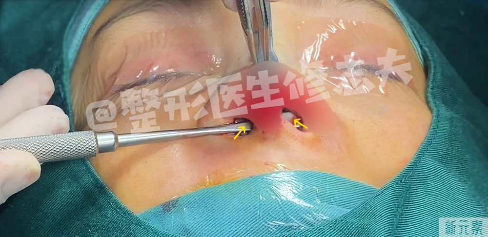 这就是所谓“年抛鼻”?更离奇的事出现了... 图片-14