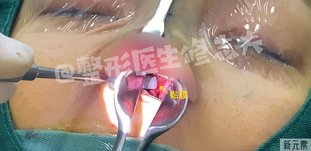 这就是所谓“年抛鼻”?更离奇的事出现了... 图片-17