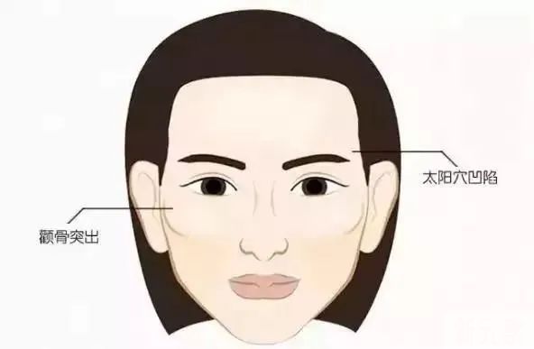 如何判断自己是颧骨高还是太阳穴凹陷? 图片-2