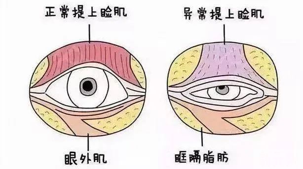 同样都是单眼皮，为何超模的看起来高级感十足? 图片-24