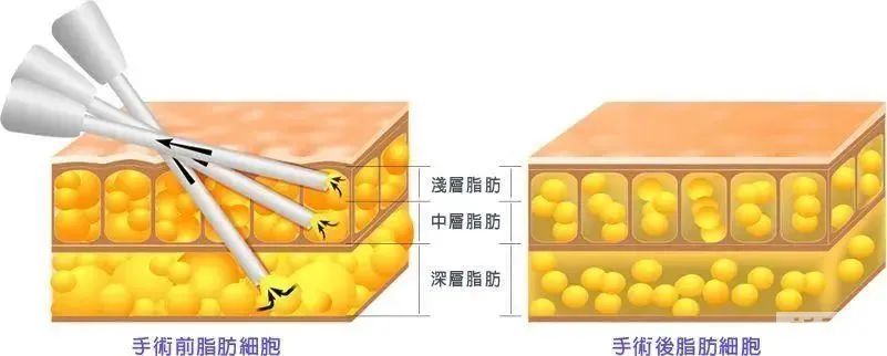 一到春夏就抢爆，这个项目真的绝! 图片-8