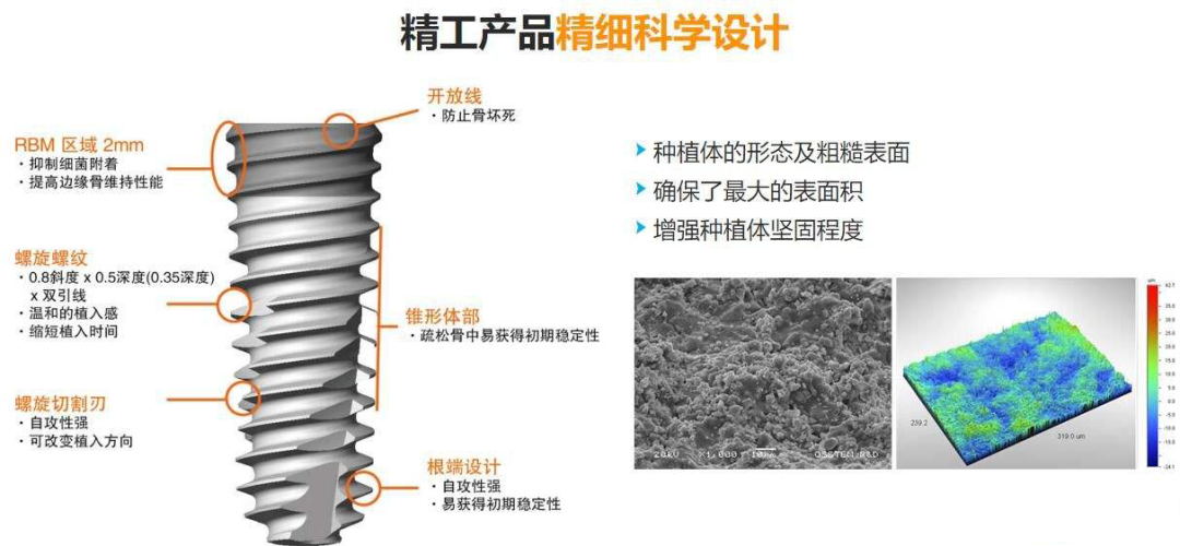 种牙需要多少钱，种牙医院怎么选，你心里有底吗? 图片-8