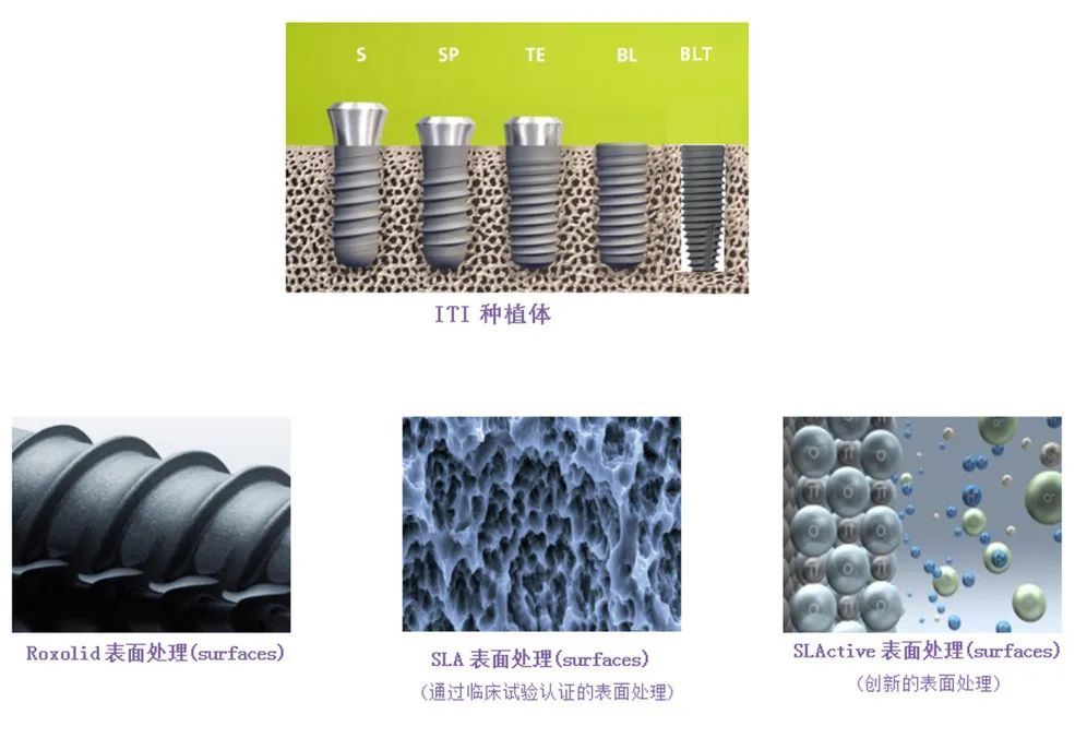 种牙需要多少钱，种牙医院怎么选，你心里有底吗? 图片-7