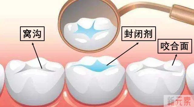 儿童护牙