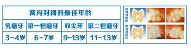 儿童护牙