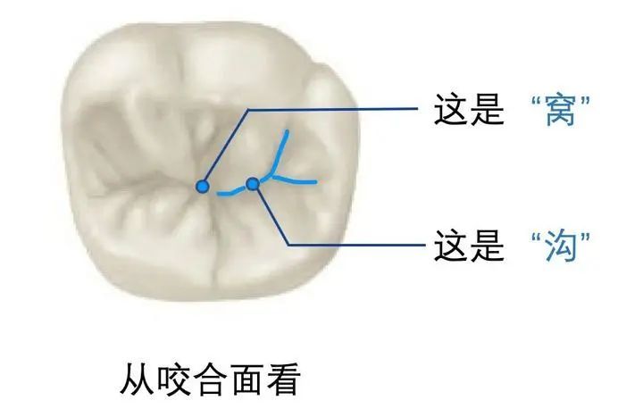 儿童护牙