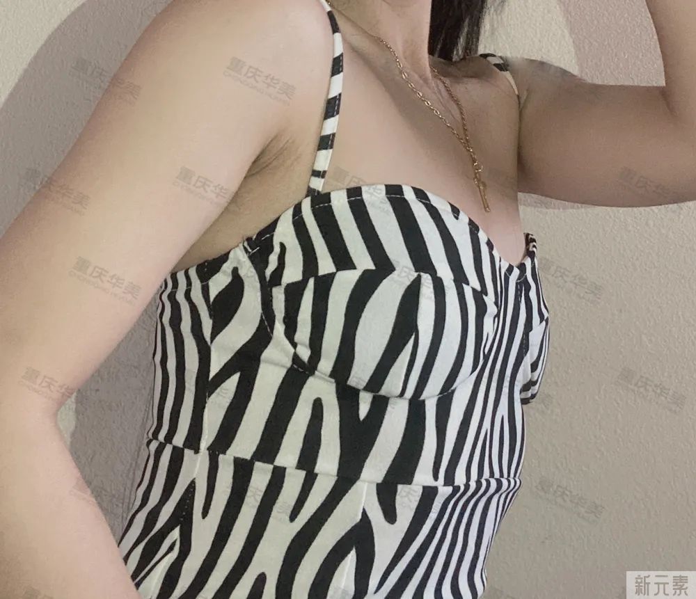 隆胸后，你的生活有变满意吗?我们采访了50+女性 图片-5