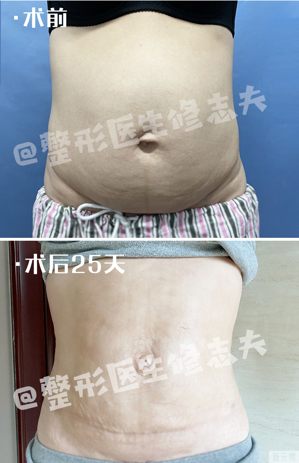 同样是腰，为何别人的腰线那么优秀? 图片-9