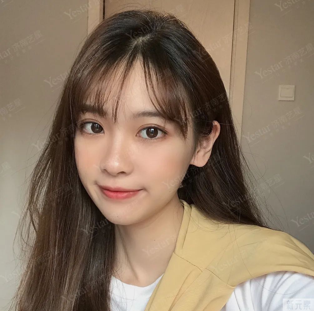 眼角开到间距只剩1厘米!?网红的畸形审美有多可怕... 图片-5