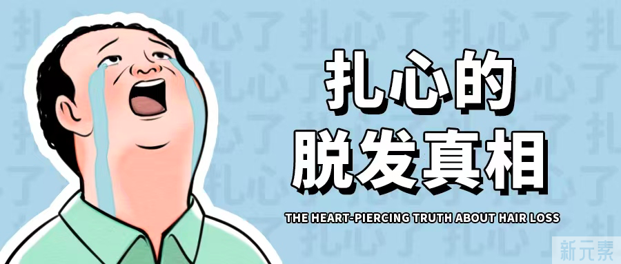 想要治疗脱发，必须要知道的几件事 图片-2