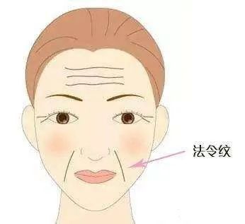 川字纹、抬头纹、鱼尾纹这么多皱纹，注射除皱后，脸会僵吗? 图片-3